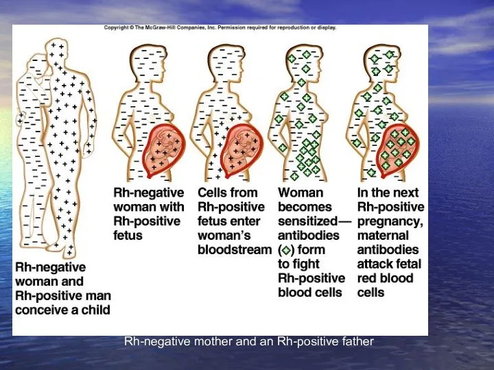 About 1 in 10 pregnancies involve an Rh-negative mother and an Rh-positive father