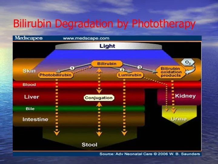Bilirubin Degradation by Phototherapy