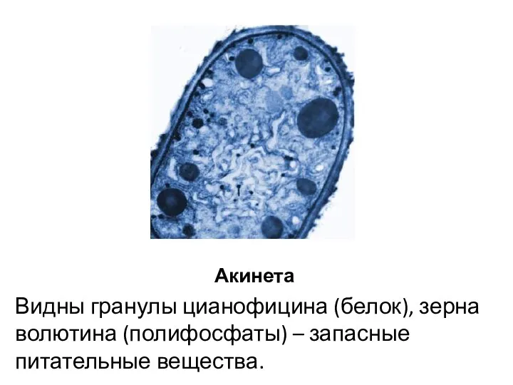 Акинета Видны гранулы цианофицина (белок), зерна волютина (полифосфаты) – запасные питательные вещества.