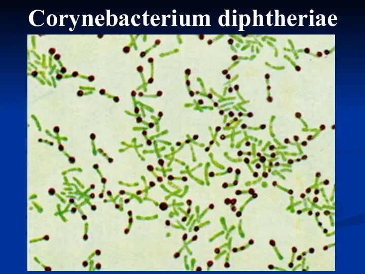 Corynebacterium diphtheriae