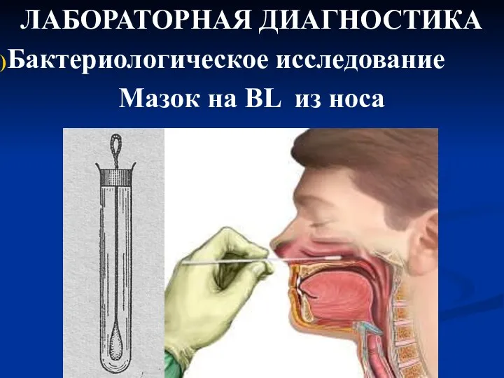 ЛАБОРАТОРНАЯ ДИАГНОСТИКА Бактериологическое исследование Мазок на BL из носа