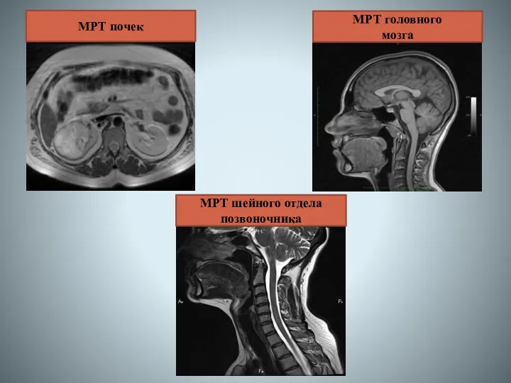 МРТ головного мозга МРТ шейного отдела позвоночника МРТ почек