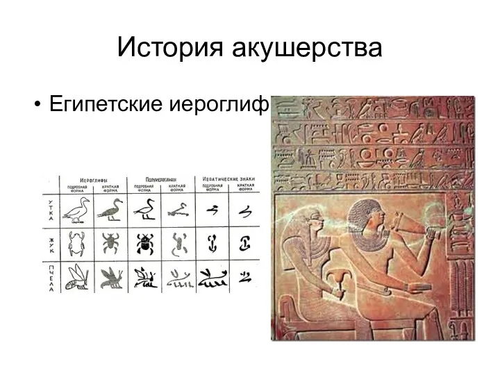 История акушерства Египетские иероглифы