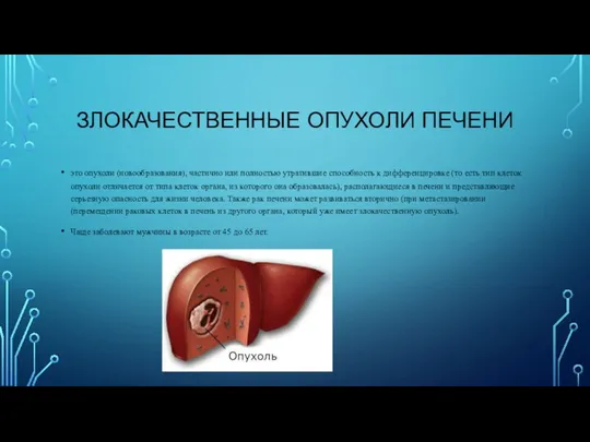 ЗЛОКАЧЕСТВЕННЫЕ ОПУХОЛИ ПЕЧЕНИ это опухоли (новообразования), частично или полностью утратившие