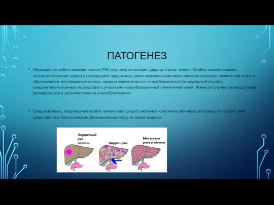 ПАТОГЕНЕЗ Обращает на себя внимание частое (70% случаев) сочетание цирроза