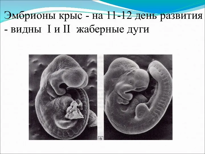Эмбрионы крыс - на 11-12 день развития - видны I и II жаберные дуги