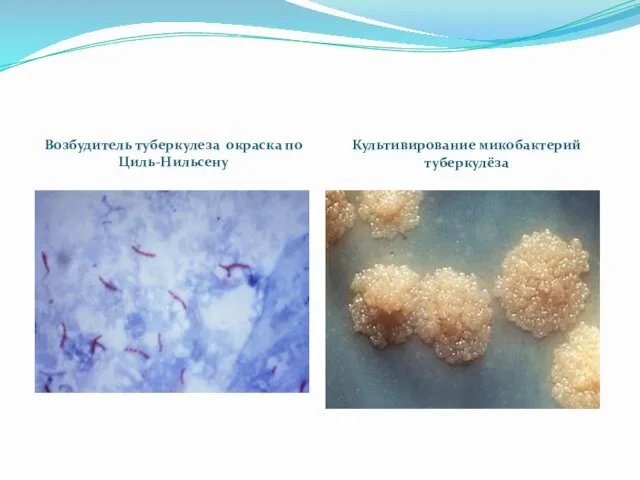 Возбудитель туберкулеза окраска по Циль-Нильсену Культивирование микобактерий туберкулёза