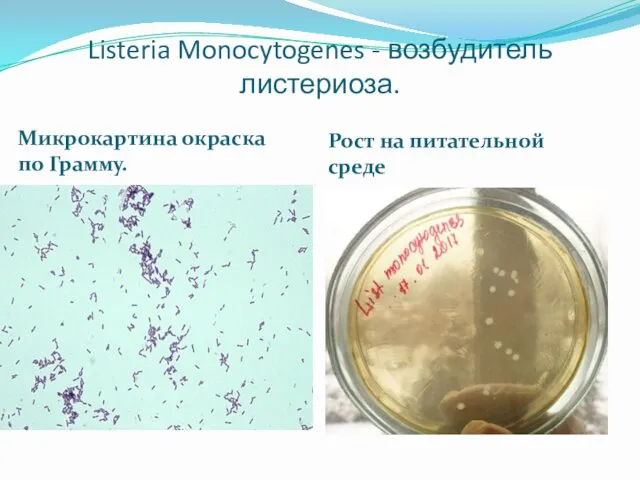 Listeria Monocytogenes - возбудитель листериоза. Микрокартина окраска по Грамму. Рост на питательной среде