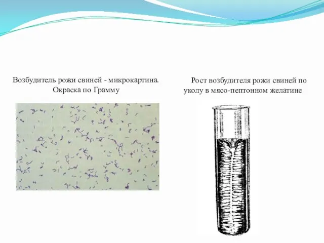 Возбудитель рожи свиней - микрокартина. Окраска по Грамму Рост возбудителя