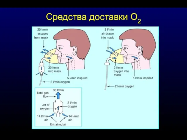 Средства доставки О2