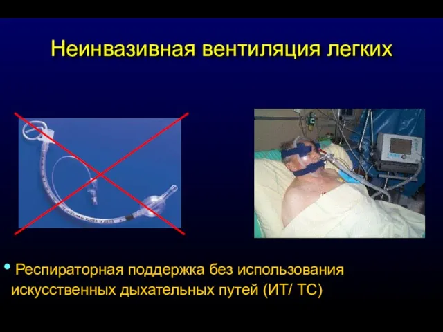 Неинвазивная вентиляция легких Респираторная поддержка без использования искусственных дыхательных путей (ИТ/ ТС)