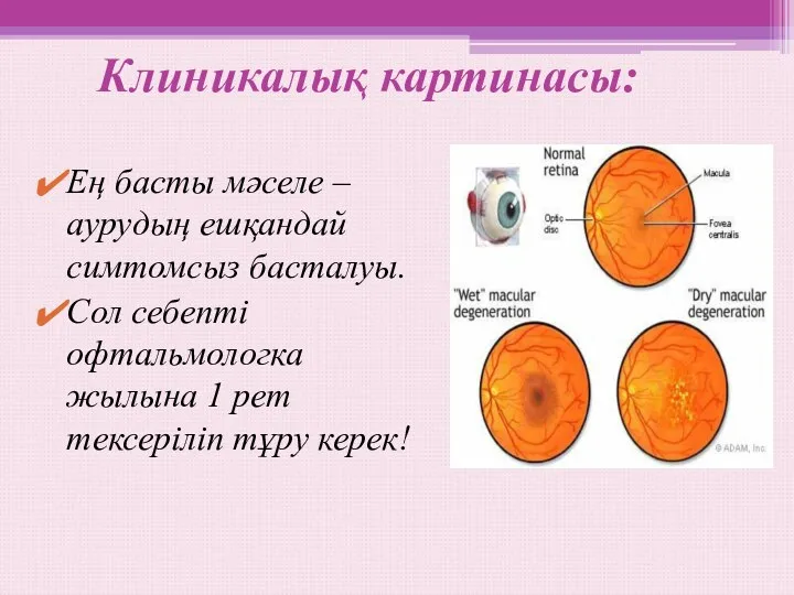 Клиникалық картинасы: Ең басты мәселе – аурудың ешқандай симтомсыз басталуы.