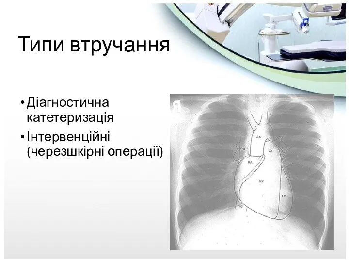 Типи втручання Діагностична катетеризація Інтервенційні (черезшкірні операції)