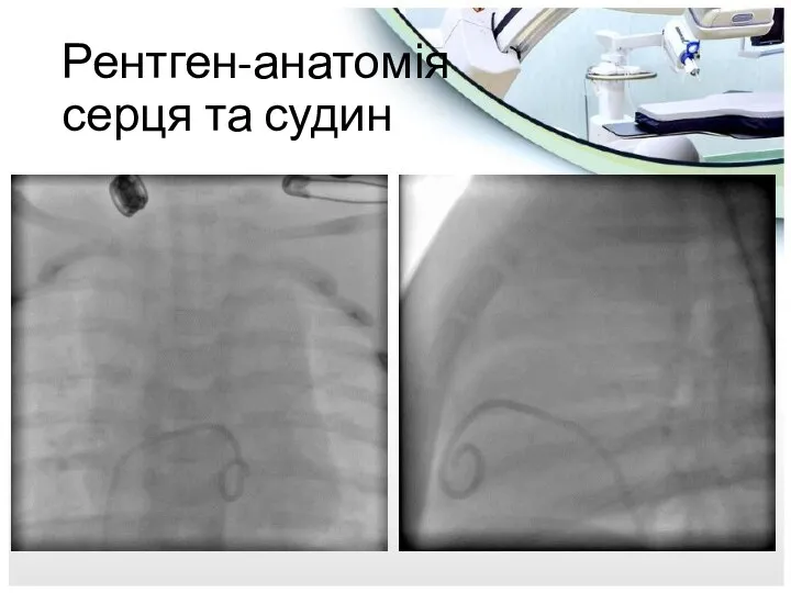 Рентген-анатомія серця та судин