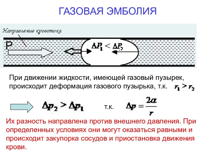 ГАЗОВАЯ ЭМБОЛИЯ Их разность направлена против внешнего давления. При определенных