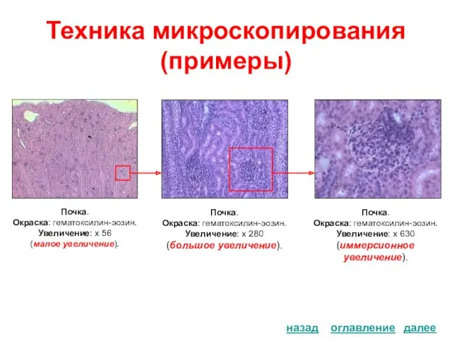 Техника микроскопирования (примеры) оглавление назад Почка. Окраска: гематоксилин-эозин. Увеличение: х