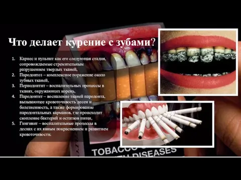 Что делает курение с зубами? Кариес и пульпит как его