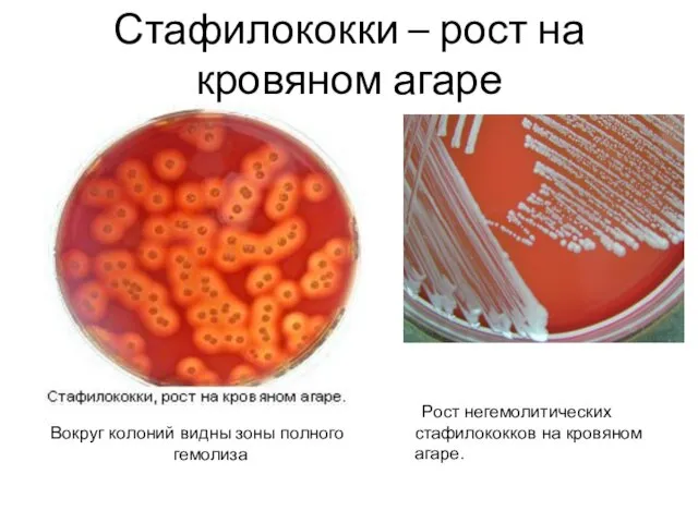 Стафилококки – рост на кровяном агаре Вокруг колоний видны зоны