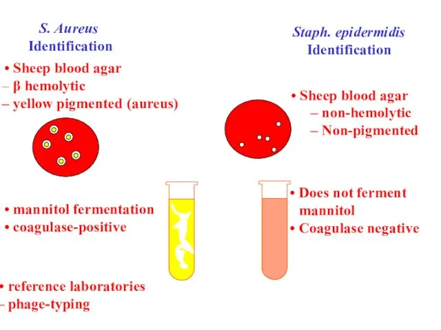 S. Aureus Identification Sheep blood agar β hemolytic yellow pigmented