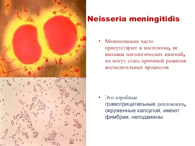 Neisseria meningitidis Менингококки часто присутствуют в носоглотке, не вызывая патологических