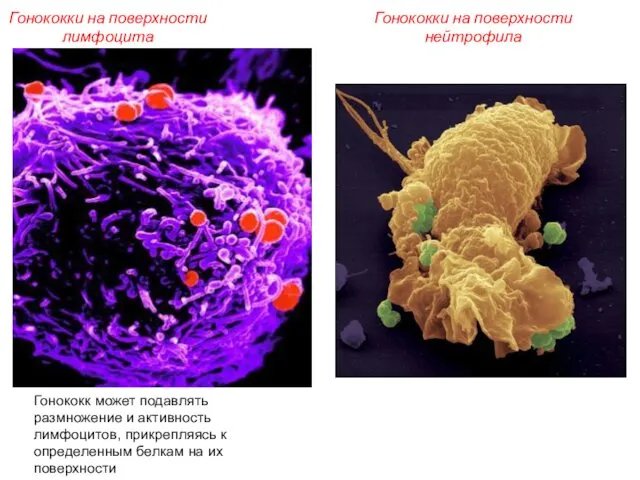 Гонококки на поверхности лимфоцита Гонококк может подавлять размножение и активность