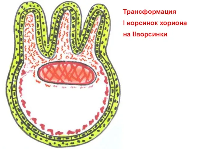 Трансформация I ворсинок хориона на IIворсинки