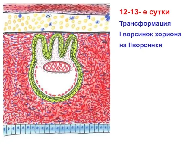 12-13- е сутки Трансформация I ворсинок хориона на IIворсинки