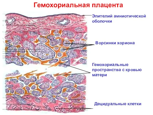 Гемохориальная плацента Эпителий амниотической оболочки Ворсинки хориона Гемохориальные пространства с кровью матери Децидуальные клетки