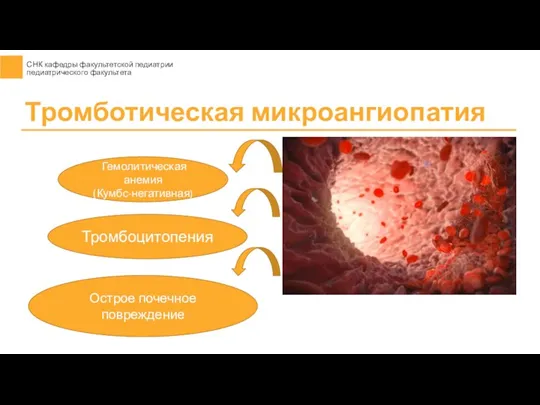Тромботическая микроангиопатия Гемолитическая анемия (Кумбс-негативная) Тромбоцитопения Острое почечное повреждение
