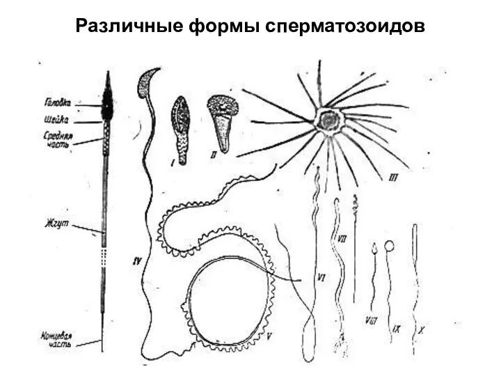 Различные формы сперматозоидов