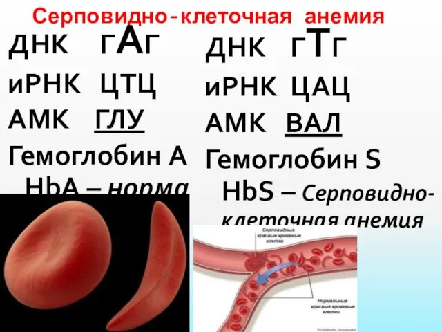Серповидно-клеточная анемия ДНК ГАГ иРНК ЦТЦ АМК ГЛУ Гемоглобин А