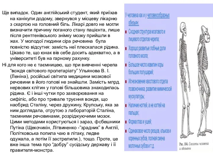 Ще випадок. Один англійський студент, який приїхав на канікули додому,