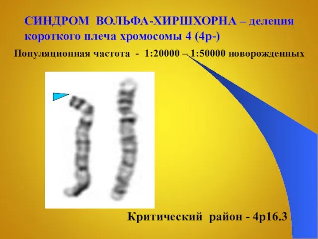 СИНДРОМ ВОЛЬФА-ХИРШХОРНА – делеция короткого плеча хромосомы 4 (4p-) Критический