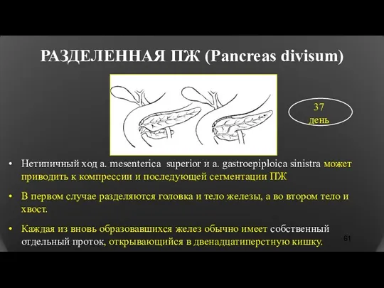 РАЗДЕЛЕННАЯ ПЖ (Pancreas divisum) Нетипичный ход a. mesenterica superior и a. gastroepiploica sinistra
