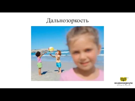 Дальнозоркость