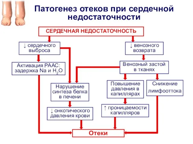 Патогенез отеков при сердечной недостаточности