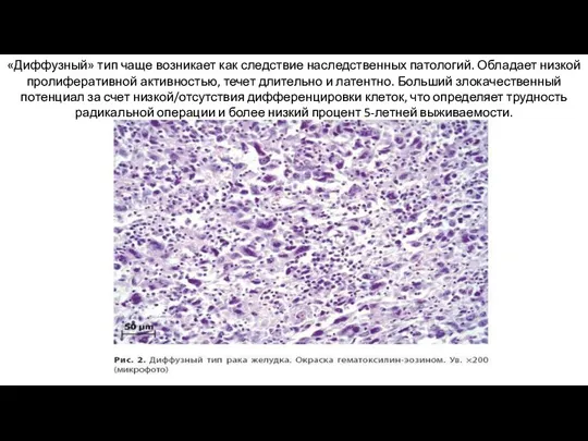 «Диффузный» тип чаще возникает как следствие наследственных патологий. Обладает низкой