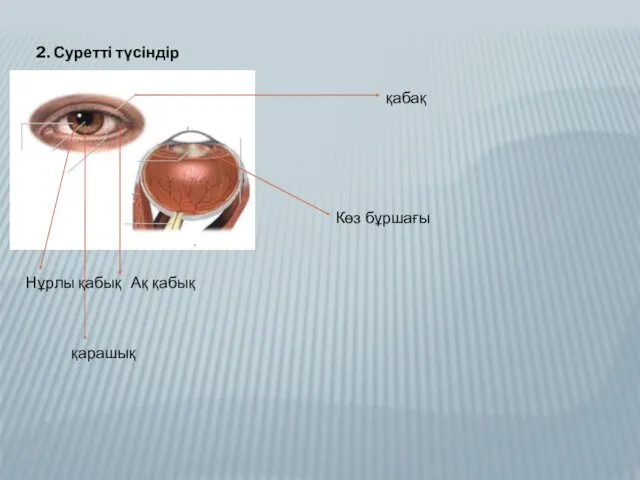 2. Суретті түсіндір қабақ Ақ қабық қарашық Нұрлы қабық Көз бұршағы