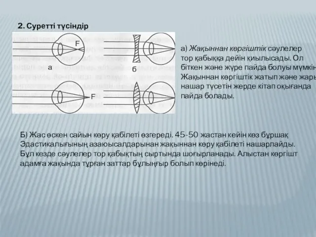 2. Суретті түсіндір а) Жақыннан көргіштік сәулелер тор қабыққа дейін