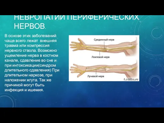 НЕВРОПАТИИ ПЕРИФЕРИЧЕСКИХ НЕРВОВ. В основе этих заболеваний чаще всего лежат