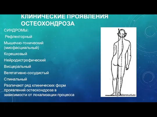 КЛИНИЧЕСКИЕ ПРОЯВЛЕНИЯ ОСТЕОХОНДРОЗА СИНДРОМЫ: Рефлекторный Мышечно-тонический (миофасциальный) Корешковый Нейродистрофический Висцеральный