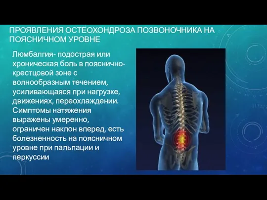 ПРОЯВЛЕНИЯ ОСТЕОХОНДРОЗА ПОЗВОНОЧНИКА НА ПОЯСНИЧНОМ УРОВНЕ Люмбалгия- подострая или хроническая