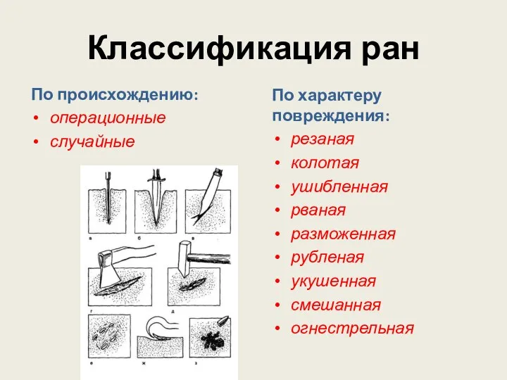 Классификация ран По происхождению: операционные случайные По характеру повреждения: резаная