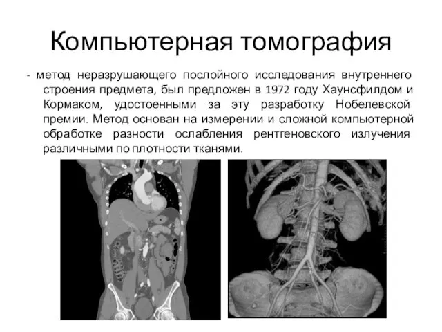 Компьютерная томография - метод неразрушающего послойного исследования внутреннего строения предмета, был предложен в