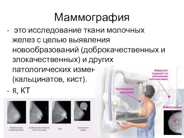 Маммография это исследование ткани молочных желез с целью выявления новообразований (доброкачественных и злокачественных)