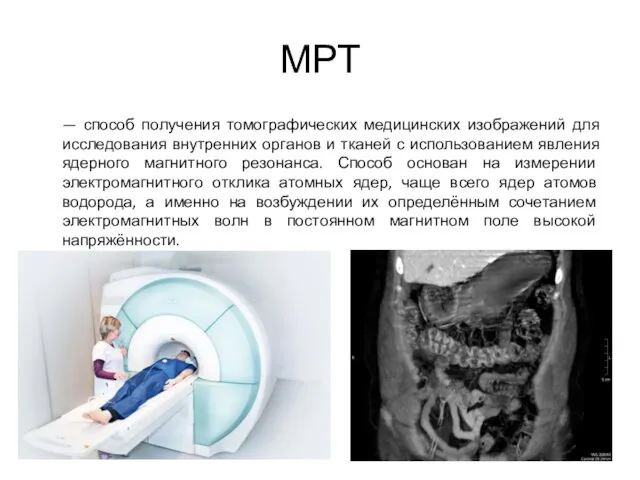 МРТ — способ получения томографических медицинских изображений для исследования внутренних органов и тканей