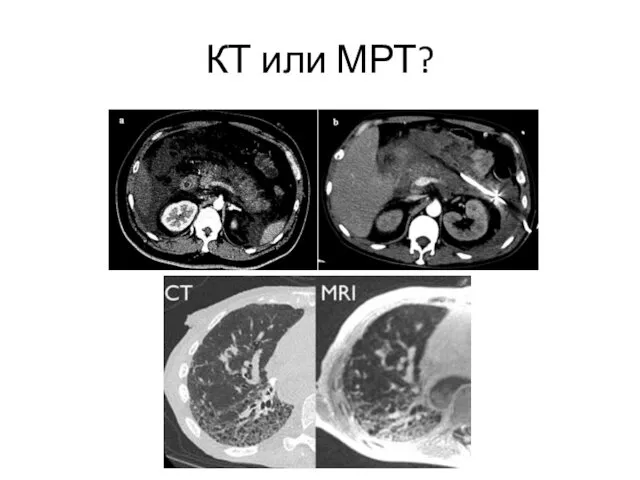 КТ или МРТ?