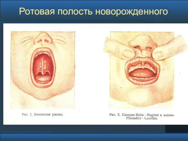 Ротовая полость новорожденного