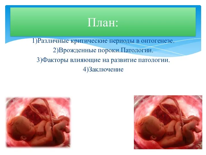 1)Различные критические периоды в онтогенезе. 2)Врожденные пороки.Патологии. 3)Факторы влияющие на развитие патологии. 4)Заключение План: