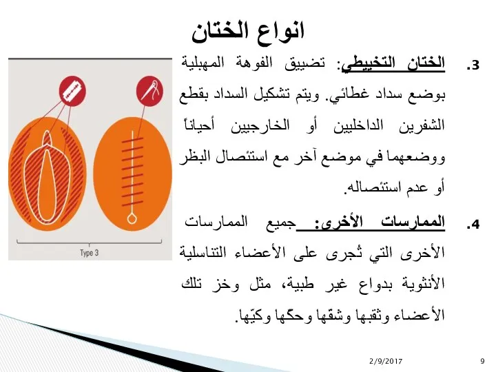 الختان التخييطي: تضييق الفوهة المهبلية بوضع سداد غطائي. ويتم تشكيل